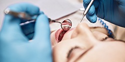 Closeup of woman during dental checkup
