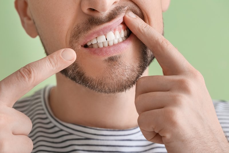 a man showing signs of gingivitis 